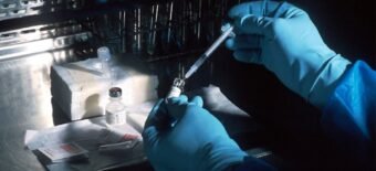 Understanding Common DNA Tests: What Your Results Really Mean
